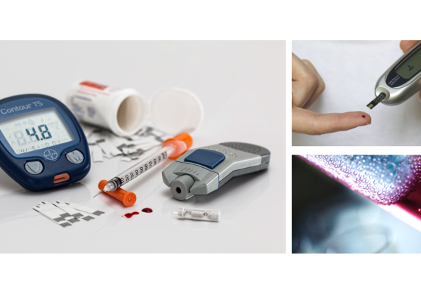 fedmeoperation-diabetes-type-2
