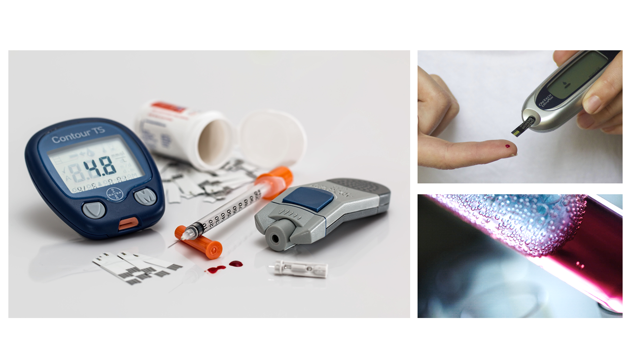 obesity-surgery-diabetes-type-2